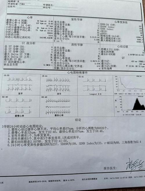 21ti9000正b电压低故障